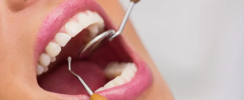 dentist in Cardiff examining female patient teeth.