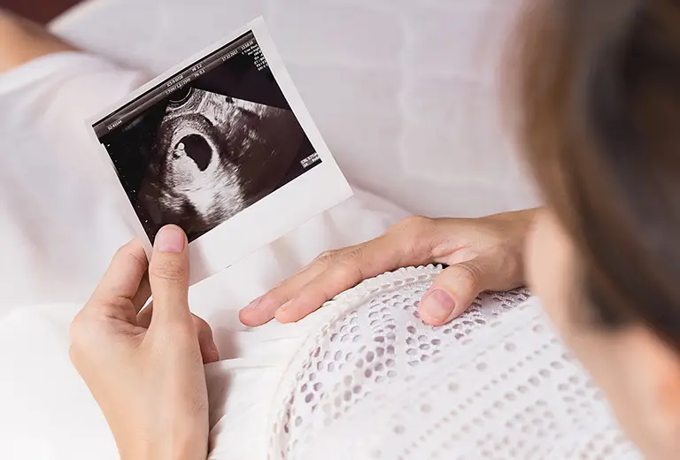 pregnant woman holding her belly whilst looking t ultrasound scan of the baby